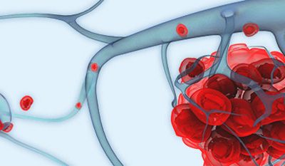 Circulating Tumor Cells biopsia liquida genolife
células circulantes tumorales
CTCs