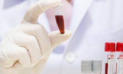 biopsia liquida genolife biopsia liquida genolife